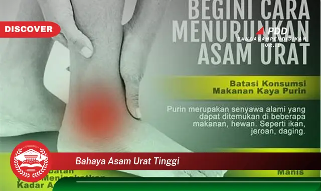 bahaya asam urat tinggi