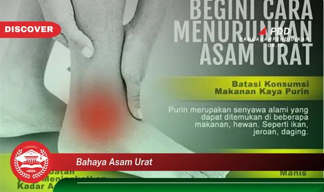 bahaya asam urat