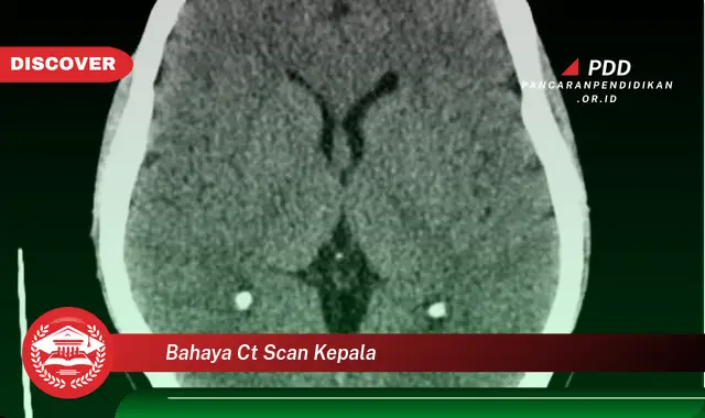 bahaya ct scan kepala