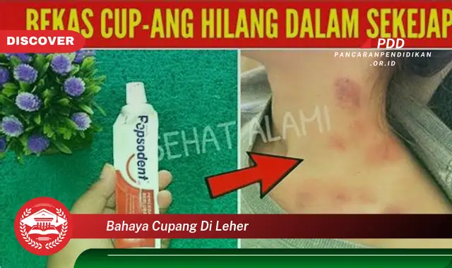 Inilah 5 Bahaya Cupang di Leher yang Jarang Diketahui