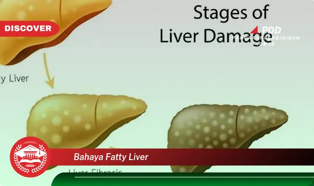 bahaya fatty liver