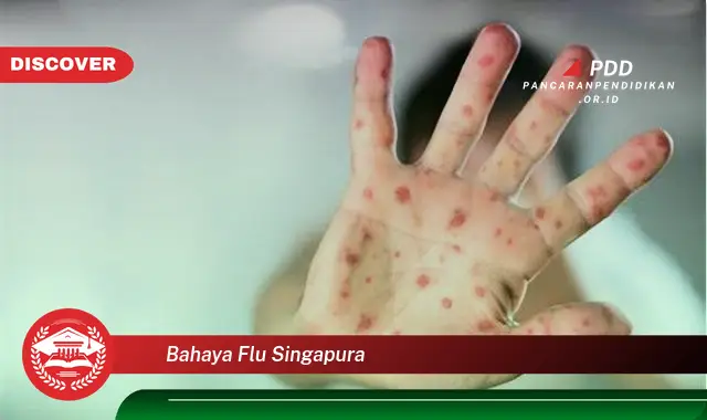 bahaya flu singapura