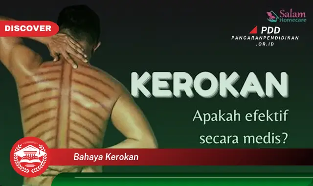 bahaya kerokan