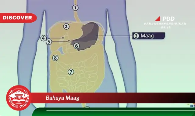 bahaya maag