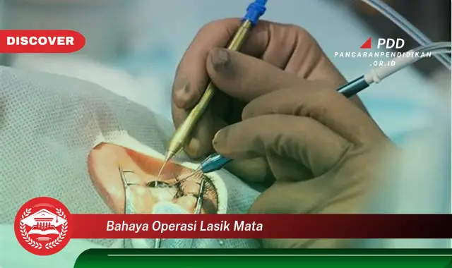 bahaya operasi lasik mata