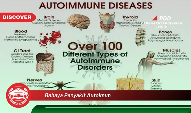 bahaya penyakit autoimun