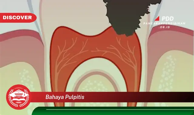 bahaya pulpitis